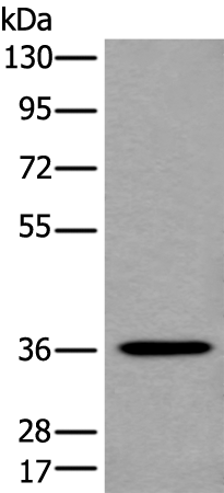 NCR1 Polyclonal Antibody (E-AB-16312)
