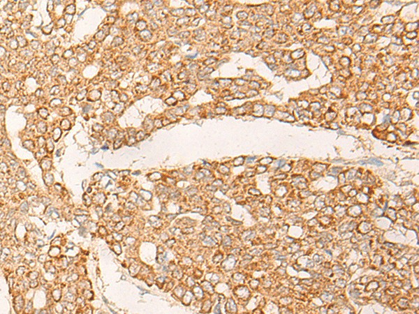 KRT9 Polyclonal Antibody (E-AB-19782)