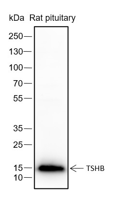 Recombinant TSHB Monoclonal Antibody (AN301422L)