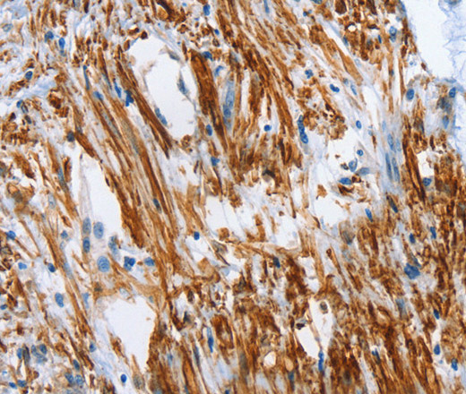 SHROOM2 Polyclonal Antibody (E-AB-12982)