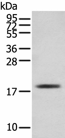 TNNC1 Polyclonal Antibody (E-AB-18400)