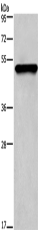 CK-14 Polyclonal Antibody (E-AB-15556)