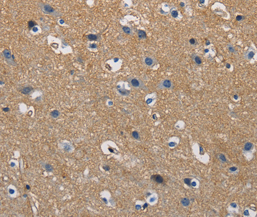 GSTA2 Polyclonal Antibody (E-AB-10939)
