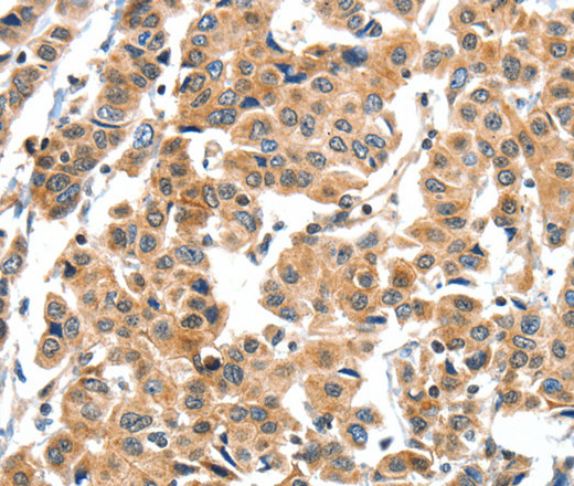XBP1 Polyclonal Antibody (E-AB-10674)