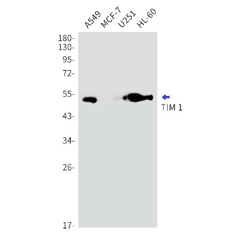 Recombinant Hepatitis A Virus Cellular Receptor 1 Monoclonal Antibody (E-AB-81495)