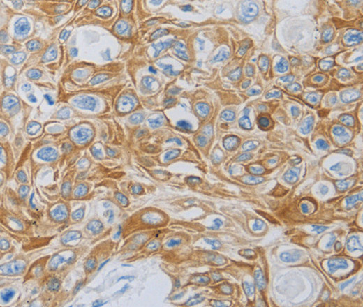 MC5R Polyclonal Antibody (E-AB-12557)