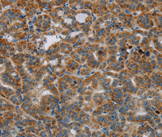 HSD17B14 Polyclonal Antibody (E-AB-15108)