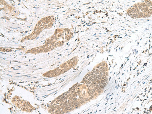 ENSA Polyclonal Antibody (E-AB-18885)