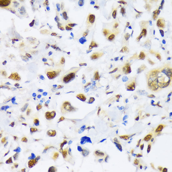 EP300 Polyclonal Antibody (E-AB-65993)