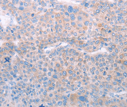 SPATA6 Polyclonal Antibody (E-AB-10665)