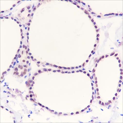 Recombinant PAX8 Monoclonal Antibody (AN301620L)