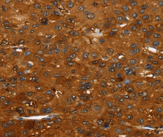 FGFR3 Polyclonal Antibody (E-AB-15633)