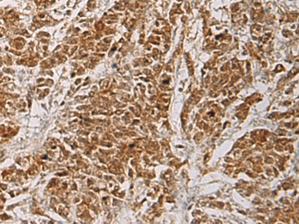 HOXC5 Polyclonal Antibody (E-AB-18093)