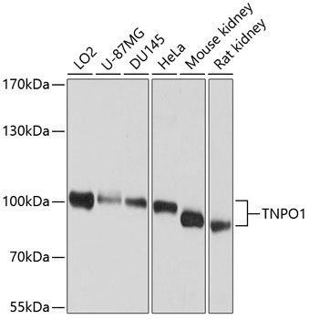 TNPO1 Polyclonal Antibody (E-AB-65625)