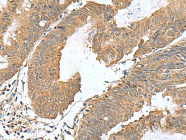 RAB23 Polyclonal Antibody (E-AB-53104)