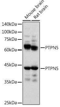 PTPN5 Polyclonal Antibody (E-AB-91586)