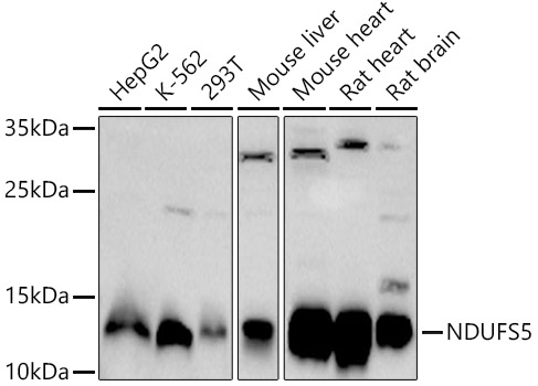 NDUFS5 Polyclonal Antibody (E-AB-92383)