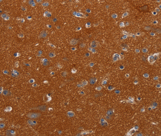 NOX3 Polyclonal Antibody (E-AB-13465)
