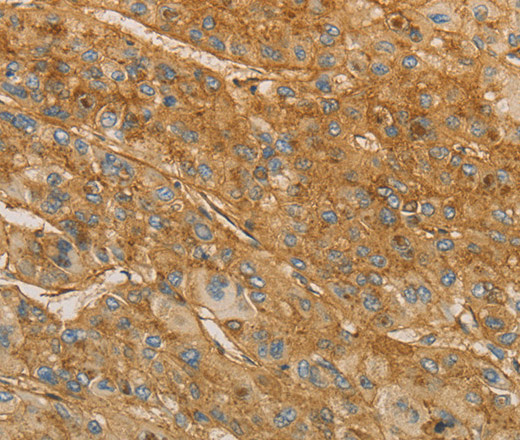 VTN Polyclonal Antibody (E-AB-10905)