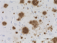 Purified anti-β-Amyloid, 17-24 Antibody (Previously Covance catalog# SIG-39220) (800712)