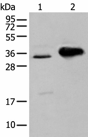 ATP6V1E2 Polyclonal Antibody (E-AB-18425)