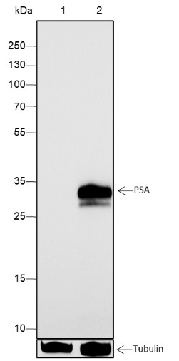 Recombinant PSA Monoclonal Antibody (AN301637L)