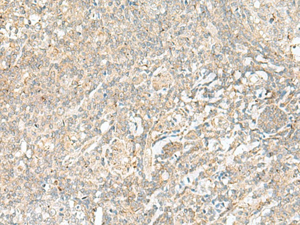 BEX2 Polyclonal Antibody (E-AB-18889)