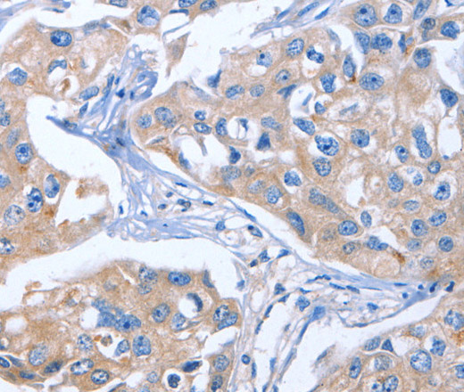 IBSP Polyclonal Antibody (E-AB-13096)