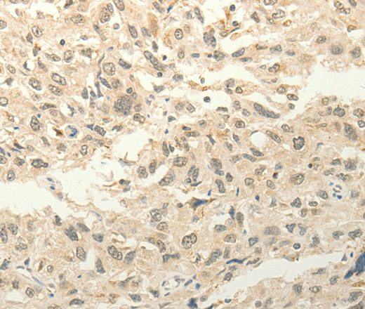 FZD8 Polyclonal Antibody (E-AB-16118)