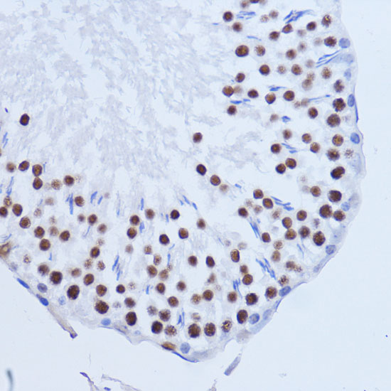 MATR3 Polyclonal Antibody (E-AB-65521)