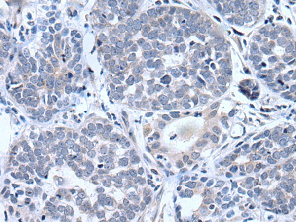 BTG4 Polyclonal Antibody (E-AB-18213)