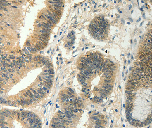 SOCS5 Polyclonal Antibody (E-AB-14357)