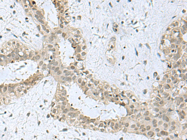 KDM3B Polyclonal Antibody (E-AB-52091)