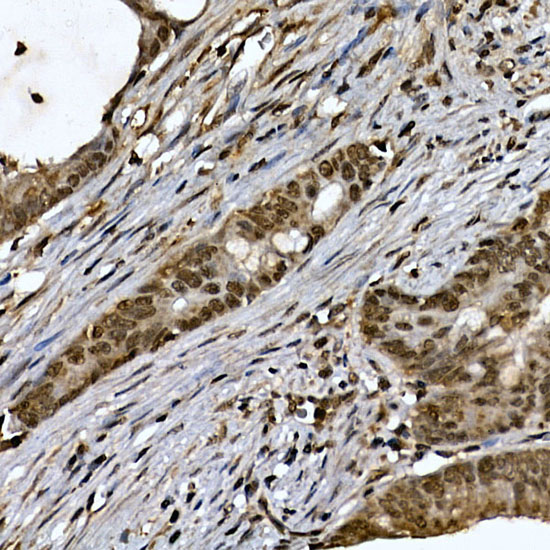 ZNF213 Polyclonal Antibody (E-AB-92309)