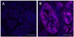 Alexa Fluor® 647 anti-CD340 (ErbB2/HER-2) Antibody (639955)