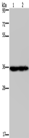 NDUFA9 Polyclonal Antibody (E-AB-11427)