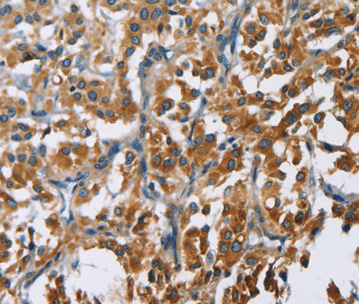 CARD9 Polyclonal Antibody (E-AB-14823)