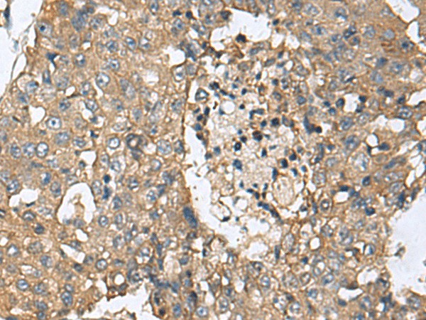 CD59 Polyclonal Antibody (E-AB-19113)