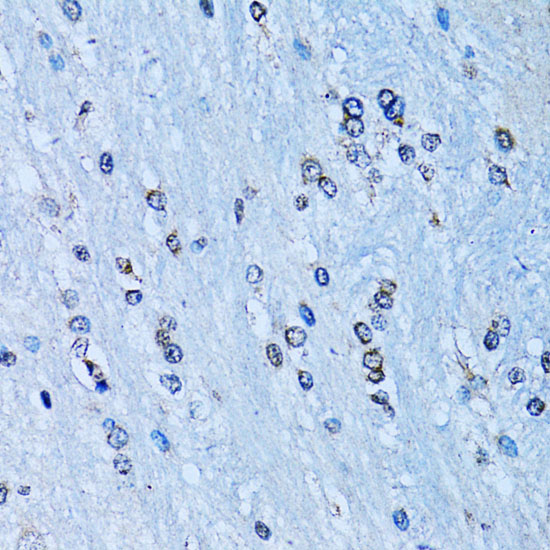 NFkB p100 / p52 Polyclonal Antibody (E-AB-60843)