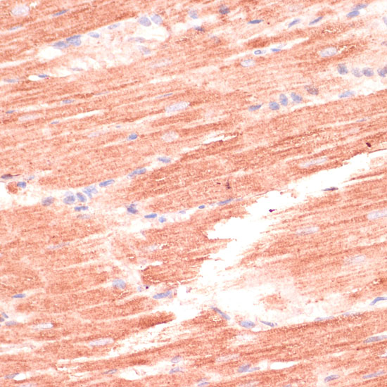 MARK3 Polyclonal Antibody (E-AB-92152)