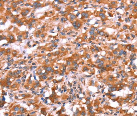 GAS8 Polyclonal Antibody (E-AB-16451)