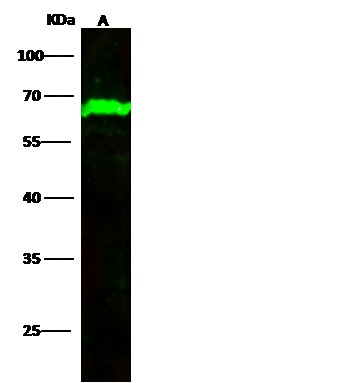 Recombinant MAP2/METAP2 Monoclonal Antibody (AN300529P)
