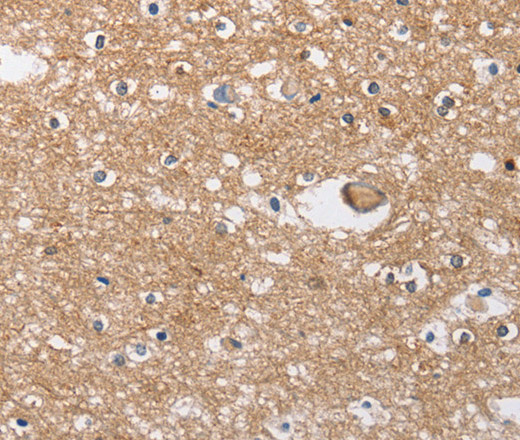 SOCS2 Polyclonal Antibody (E-AB-14356)