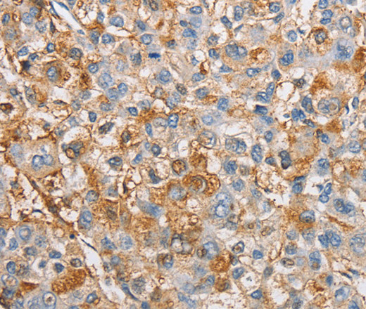 IKK gamma Polyclonal Antibody (E-AB-10845)