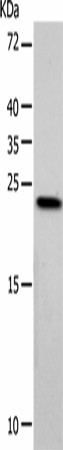 VSNL1 Polyclonal Antibody (E-AB-53201)