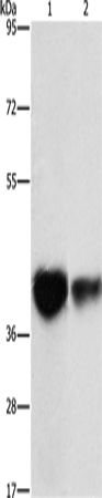 IDH3G Polyclonal Antibody (E-AB-14638)