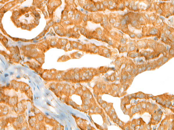 CEP72 Polyclonal Antibody (E-AB-52537)
