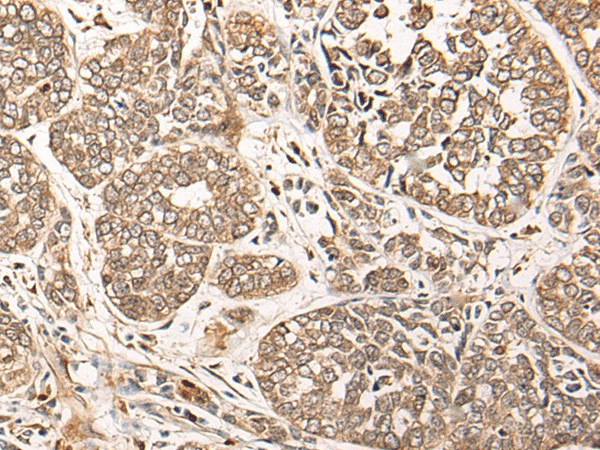CA5B Polyclonal Antibody (E-AB-19648)