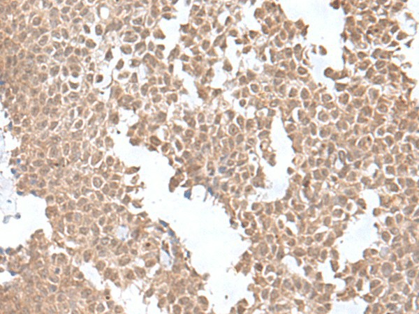 SNRNP25 Polyclonal Antibody (E-AB-52686)