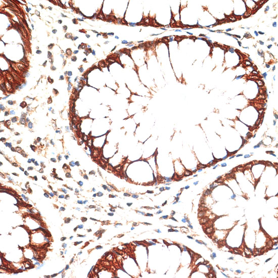 KRT13 Polyclonal Antibody (E-AB-66794)